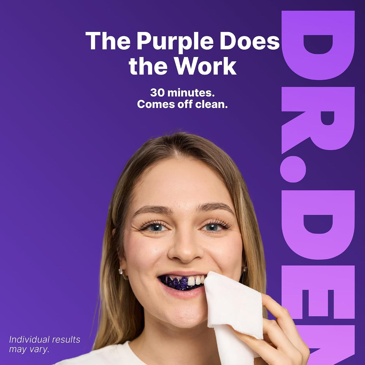 Purple Radiance Teeth Whitening System